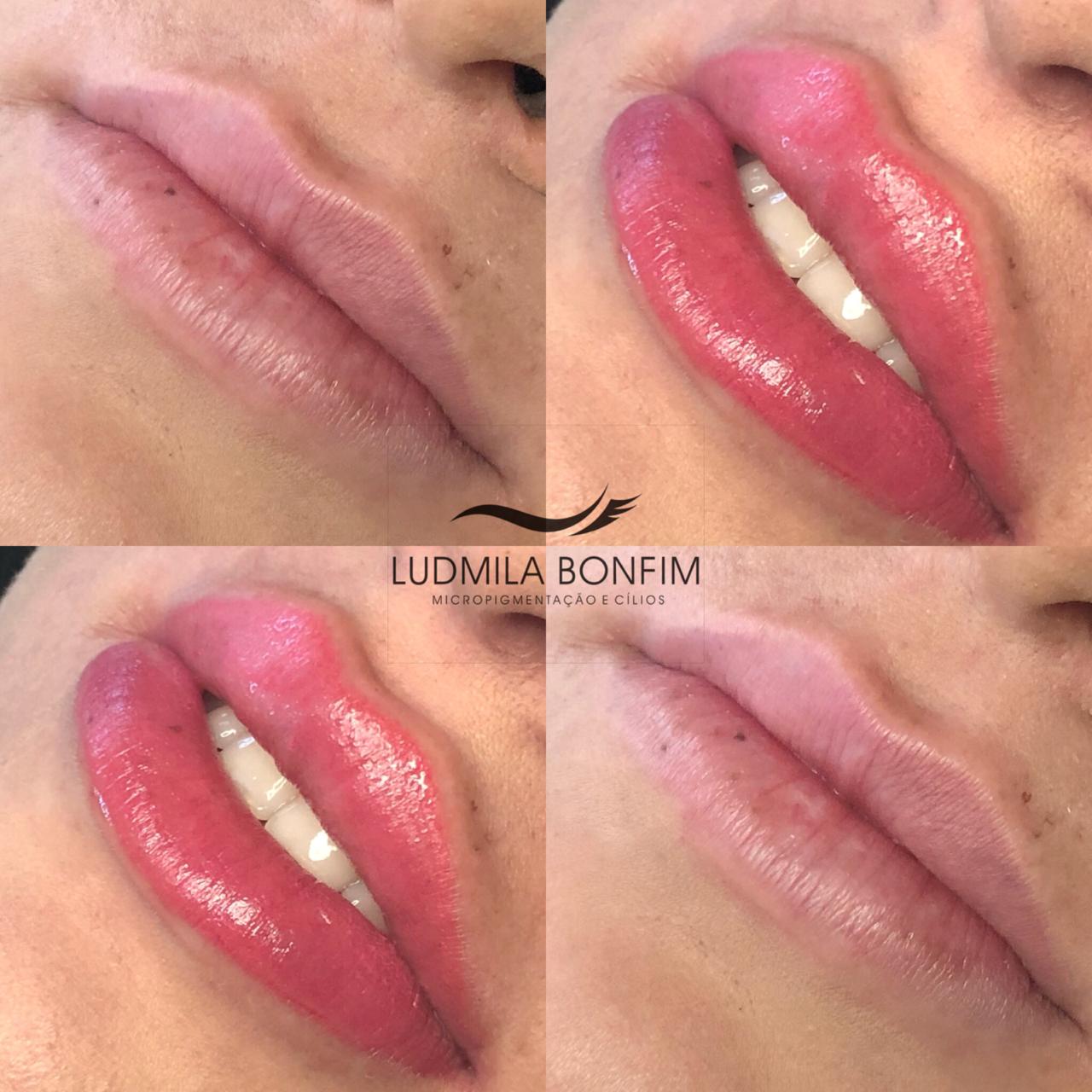 Revitalização Labial em Brasília no Espaço Ludmila Bonfim
