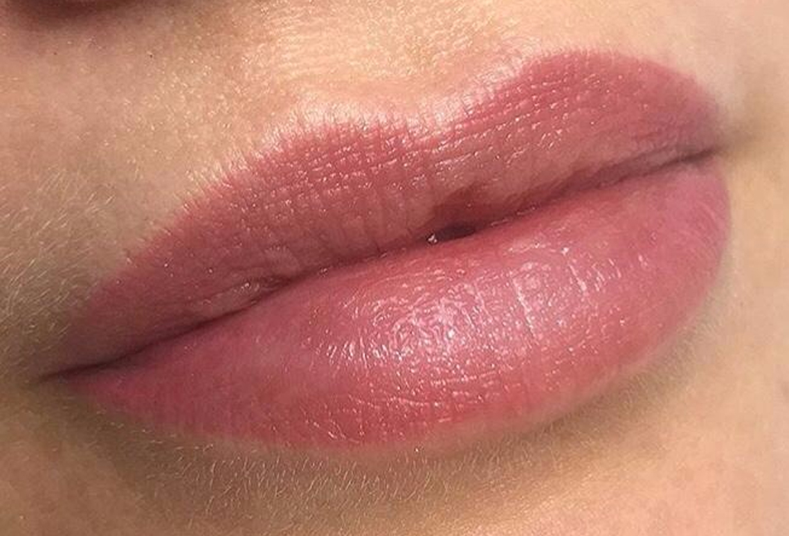 Revitalização Labial